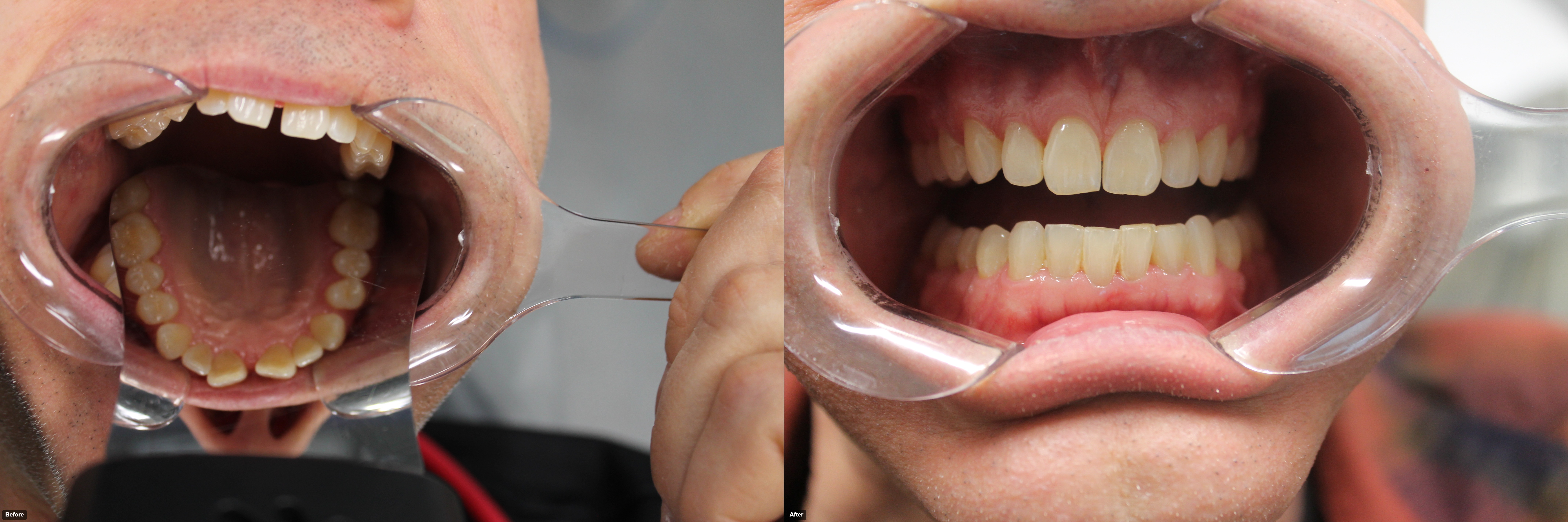 G.Loukmas-before-after